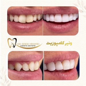 نمونه کار زیبایی دندان 8